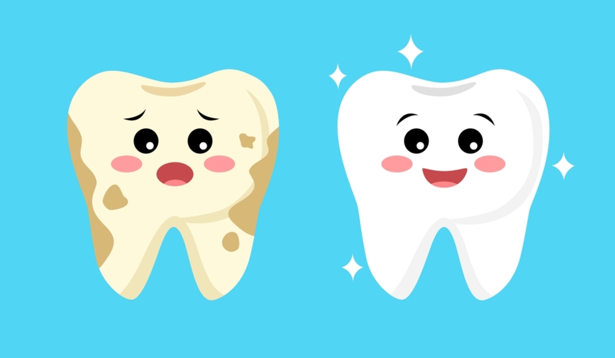 how to remove brown stains between teeth